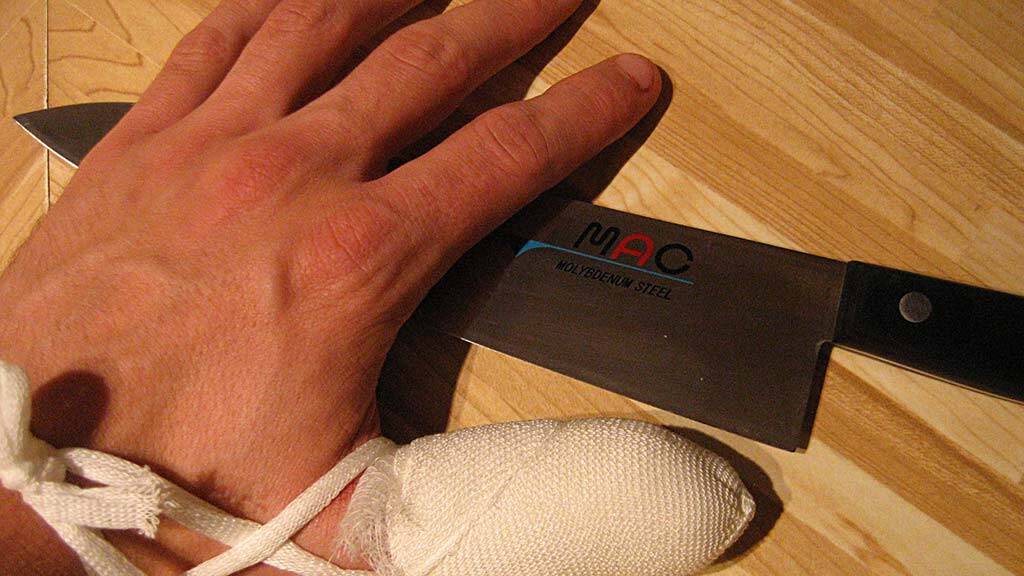 knife injury in the workplace